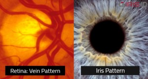 Image of retina and iris