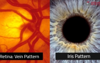 Image of retina and iris